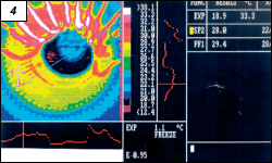 Obr. 4.