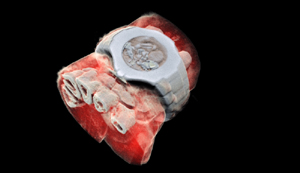 3D rentgenový snímek lidského těla