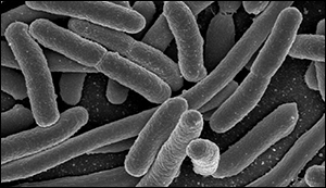 E. coli test