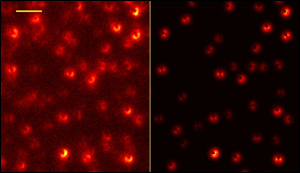 Advance in super-resolution microscopy