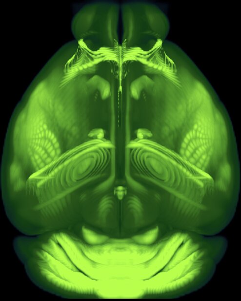 Mouse brain