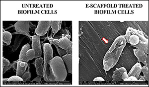 New technology for wound treatment