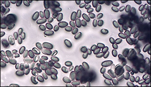 Mould helping to improve batteries