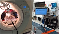Inside an MRI, a Non-Metallic Robot Performs Prostate Surgery