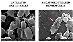 Researchers develop novel wound healing technology